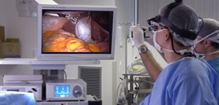 Anestesia na Minilaparoscopia